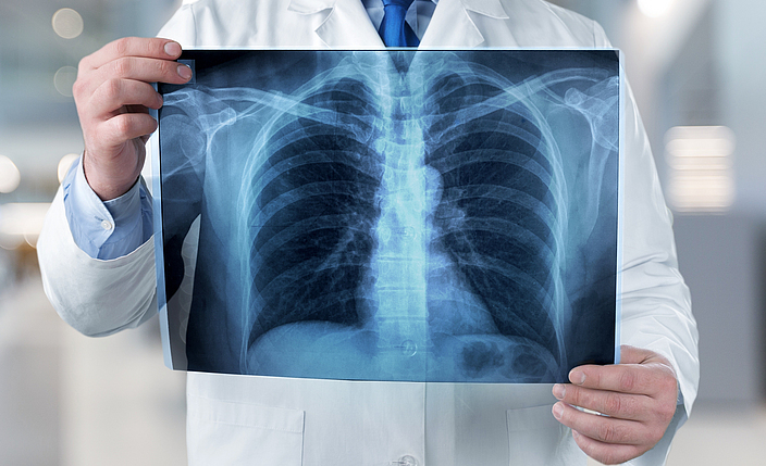 Ein Arzt hält ein Röntgenbild in seinen Händen.
