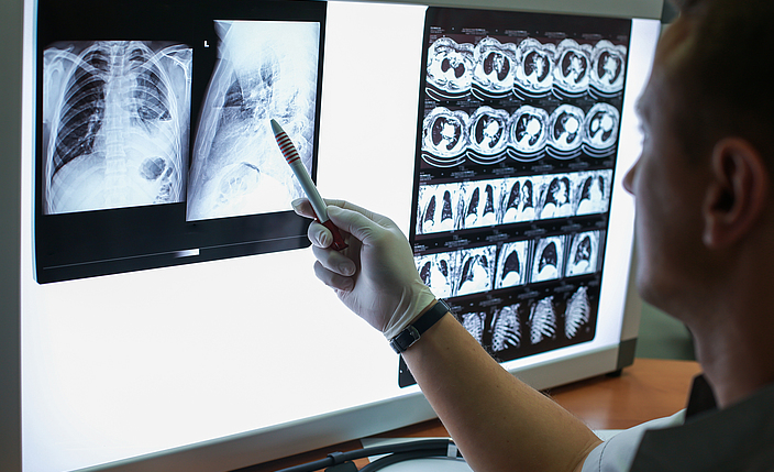 Ein Arzt schaut sich ein Röntgenbild eines Brustkorbs an.